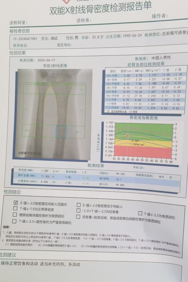 雙能X射線骨密度儀：準(zhǔn)確測(cè)量骨密度，助力骨質(zhì)疏松防治，守護(hù)骨骼健康